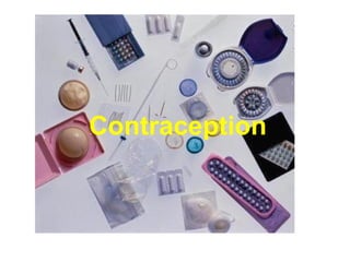 Contraception
 