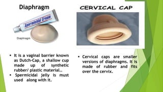  It is a vaginal barrier known
as Dutch-Cap, a shallow cup
made up of synthetic
rubber/ plastic material..
 Spermicidal jelly is must
used along with it.
 Cervical caps are smaller
versions of diaphragms. It is
made of rubber and fits
over the cervix.
Diaphragm
 