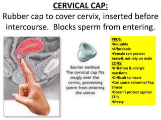 Contraceptive methods | PPTX