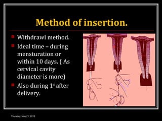 CONTRACEPTIVE METHODS | PPT
