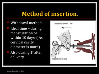 Method of insertion.
 Withdrawl method.
 Ideal time – during
mensturation or
within 10 days. ( As
cervical cavity
diameter is more)
 Also during 1st
after
delivery.
Sunday, December 11, 2016
 