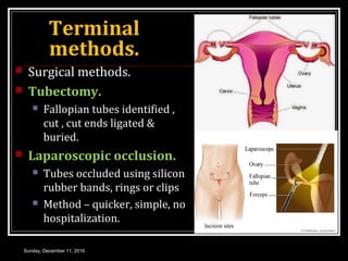 Terminal
methods.
 Surgical methods.
 Tubectomy.
 Fallopian tubes identified ,
cut , cut ends ligated &
buried.
 Laparoscopic occlusion.
 Tubes occluded using silicon
rubber bands, rings or clips
 Method – quicker, simple, no
hospitalization.
Sunday, December 11, 2016
 
