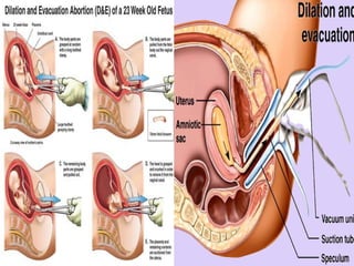 Sunday, December 11, 2016
 