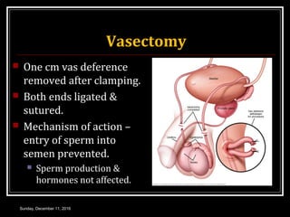 Vasectomy
 One cm vas deference
removed after clamping.
 Both ends ligated &
sutured.
 Mechanism of action –
entry of sperm into
semen prevented.
 Sperm production &
hormones not affected.
Sunday, December 11, 2016
 