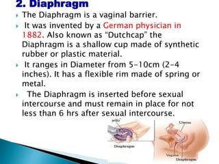 2. Diaphragm
 The Diaphragm is a vaginal barrier.
 It was invented by a German physician in
1882. Also known as “Dutchcap” the
Diaphragm is a shallow cup made of synthetic
rubber or plastic material.
 It ranges in Diameter from 5-10cm (2-4
inches). It has a flexible rim made of spring or
metal.
 The Diaphragm is inserted before sexual
intercourse and must remain in place for not
less than 6 hrs after sexual intercourse.
 