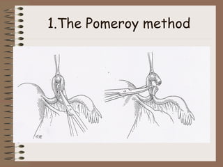 1.The Pomeroy method
 