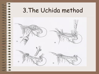 3.The Uchida method
 