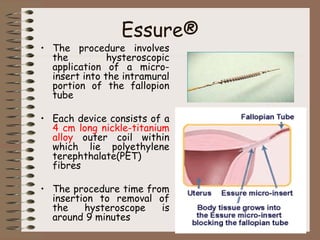 Essure®
• The procedure involves
the hysteroscopic
application of a micro-
insert into the intramural
portion of the fallopion
tube
• Each device consists of a
4 cm long nickle-titanium
alloy outer coil within
which lie polyethylene
terephthalate(PET)
fibres
• The procedure time from
insertion to removal of
the hysteroscope is
around 9 minutes
 