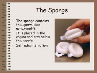 The Sponge
• The sponge contains
the spermicide
nonoxynol-9.
• It is placed in the
vagina and sits below
the cervix.
• Self administration
 