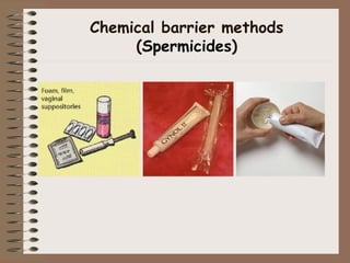 Chemical barrier methods
(Spermicides)
 