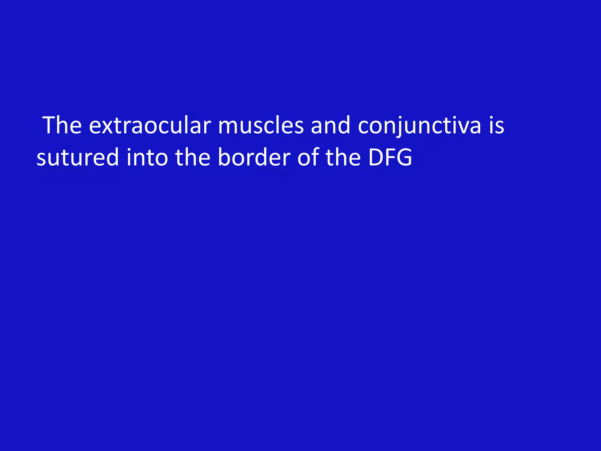 The extraocular muscles and conjunctiva is
sutured into the border of the DFG
 