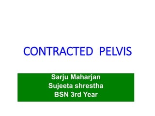 CONTRACTED PELVIS
Sarju Maharjan
Sujeeta shrestha
BSN 3rd Year
 