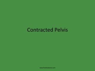 Contracted Pelvis www.freelivedoctor.com 