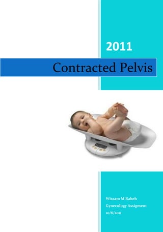 2011Wissam M RabehGynecology Assigment10/6/201118002252915285Contracted Pelvis<br />Table of Contents<br />Introduction<br />Etiology<br />Diagnosis of Contracted Pelvis<br />Mechanism of Labour in contracted pelvis<br />Management<br />Complications<br />,[object Object],The contracted pelvis is defined anatomically by being a pelvis in which one or more of its main diameters is reduced below average normal by one or more cm. Whereas obstetricians tend to define it as the pelvis in which one or more of its  main diameters are reduced to the extent that interferes with the normal mechanism of labour i.e spontaneous vaginal delivery.<br />,[object Object]