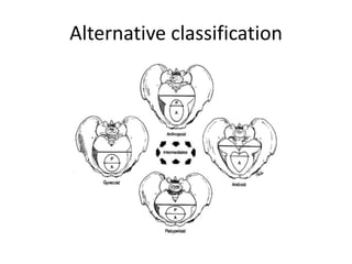 Alternative classification

 