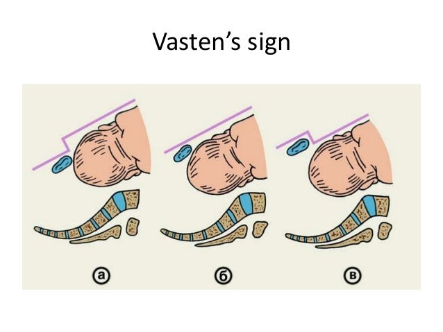 Image result for Henkel-Vasten sign
