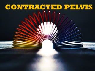 CONTRACTED PELVIS 
 