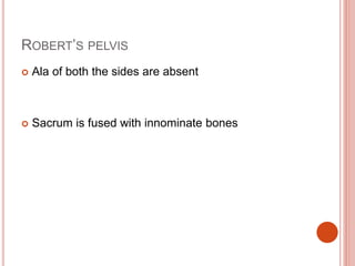 ROBERT’S PELVIS
 Ala of both the sides are absent
 Sacrum is fused with innominate bones
 