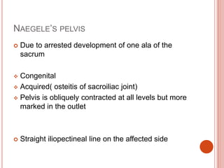 NAEGELE’S PELVIS
 Due to arrested development of one ala of the
sacrum
 Congenital
 Acquired( osteitis of sacroiliac joint)
 Pelvis is obliquely contracted at all levels but more
marked in the outlet
 Straight iliopectineal line on the affected side
 