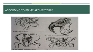 ACCORDING TO PELVIC ARCHITECTURE
 