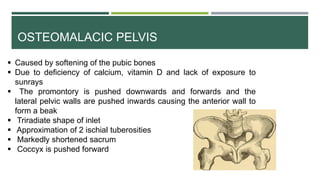 OSTEOMALACIC PELVIS
 Caused by softening of the pubic bones
 Due to deficiency of calcium, vitamin D and lack of exposure to
sunrays
 The promontory is pushed downwards and forwards and the
lateral pelvic walls are pushed inwards causing the anterior wall to
form a beak
 Triradiate shape of inlet
 Approximation of 2 ischial tuberosities
 Markedly shortened sacrum
 Coccyx is pushed forward
 