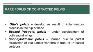 RARE FORMS OF CONTRACTED PELVIS
 Otto’s pelvis – develop as result of inflammatory
process in the hip or knee
 Beaked (rostrate) pelvis – under development of
both sacral wings
 Spondylolithetic pelvis – formed due to partial
dislocation of last lumbar vertebra in front of 1st sacral
vertebra
 