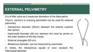 EXTERNAL PELVIMETRY
It is of little value as it measures diameters of the false pelvis.
Thom’s, Jarcho’s or crossing pelvimeter can be used for external
pelvimetry.
 Interspinous diameter (25cm): between the anterior superior
iliac spines.
 Intercrestal diameter (28 cm): between the most far points on
the outer borders of the iliac crests.
 External conjugate (20 cm).
 Bituberous diameter: can be measured by pelvimeter.
In rickets, the interspinous equals or even exceeds the
intercrestal diameter.
 