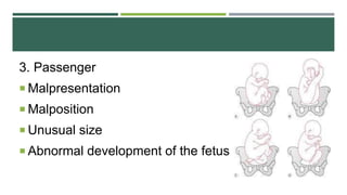 3. Passenger
 Malpresentation
 Malposition
 Unusual size
 Abnormal development of the fetus
 