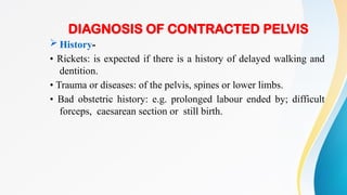 contractedpelvis-KHAZAM.pptxkfjhcyjtckvtyjc | PPTX
