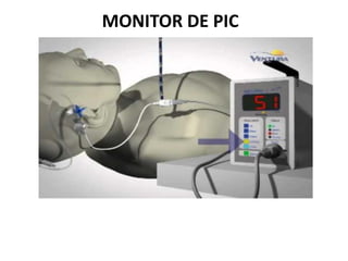 MONITOR DE PIC
 