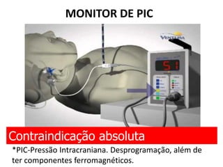 MONITOR DE PIC
Contraindicação absoluta
*PIC-Pressão Intracraniana. Desprogramação, além de
ter componentes ferromagnéticos.
 