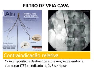 FILTRO DE VEIA CAVA
*São dispositivos destinados a prevenção de embolia
pulmonar (TEP). Indicado após 8 semanas.
Contraindicação relativa
 