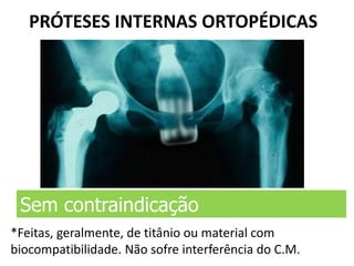 PRÓTESES INTERNAS ORTOPÉDICAS
Sem contraindicação
*Feitas, geralmente, de titânio ou material com
biocompatibilidade. Não sofre interferência do C.M.
 