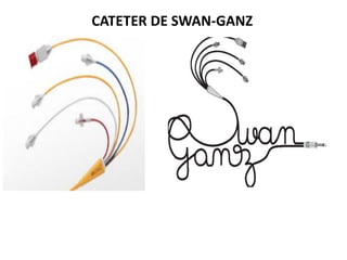 CATETER DE SWAN-GANZ
 