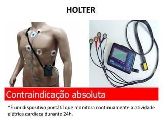 HOLTER
Contraindicação absoluta
*É um dispositivo portátil que monitora continuamente a atividade
elétrica cardíaca durante 24h.
 