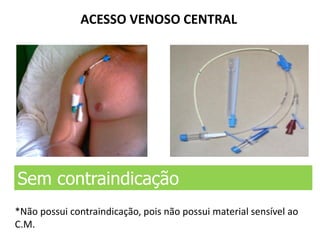 ACESSO VENOSO CENTRAL
Sem contraindicação
*Não possui contraindicação, pois não possui material sensível ao
C.M.
 