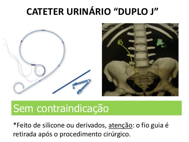 Contraindicações Na Rm