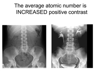 The average atomic number is
INCREASED positive contrast
 