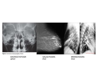 DACROCYSTOGR
APHY
GALACTOGRA
PHY
BRANCHOGRA
PHY
 