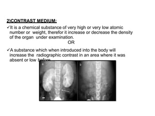 2)CONTRAST MEDIUM:
It is a chemical substance of very high or very low atomic
number or weight, therefor it increase or decrease the density
of the organ under examination.
OR
A substance which when introduced into the body will
increase the radiographic contrast in an area where it was
absent or low before.
 