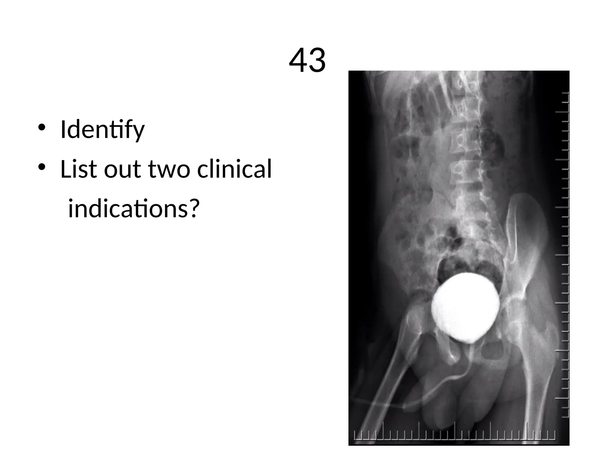 Contrast and special radiographic procedures New (1).ppt