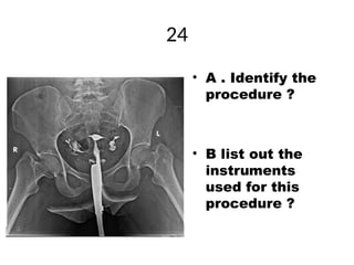 Contrast and special radiographic procedures New (1).ppt