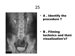 Contrast and special radiographic procedures New (1).ppt