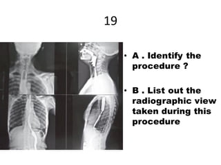 Contrast and special radiographic procedures New (1).pdf