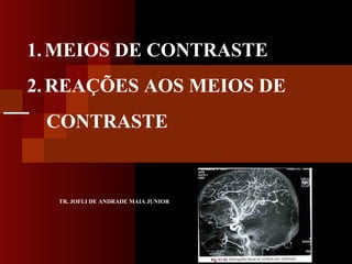 1. MEIOS DE CONTRASTE
2. REAÇÕES AOS MEIOS DE
CONTRASTE

TR. JOFLI DE ANDRADE MAIA JUNIOR

 