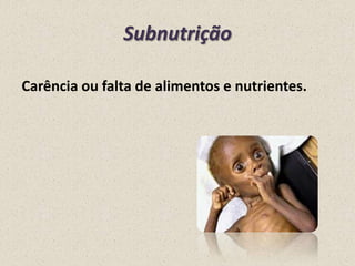 Subnutrição
Carência ou falta de alimentos e nutrientes.

 