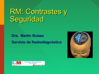 RM: Contrastes yRM: Contrastes y
SeguridadSeguridad
Dra. Martín BoizasDra. Martín Boizas
Servicio de RadiodiagnósticoServicio de Radiodiagnóstico
 