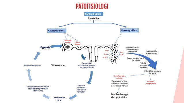 Contrast Induced Nephropathy CIN Angiography | PDF