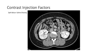 Direct Inject Contrast Principle of Contrast Media Injection Techniques in Computed Tomography ...