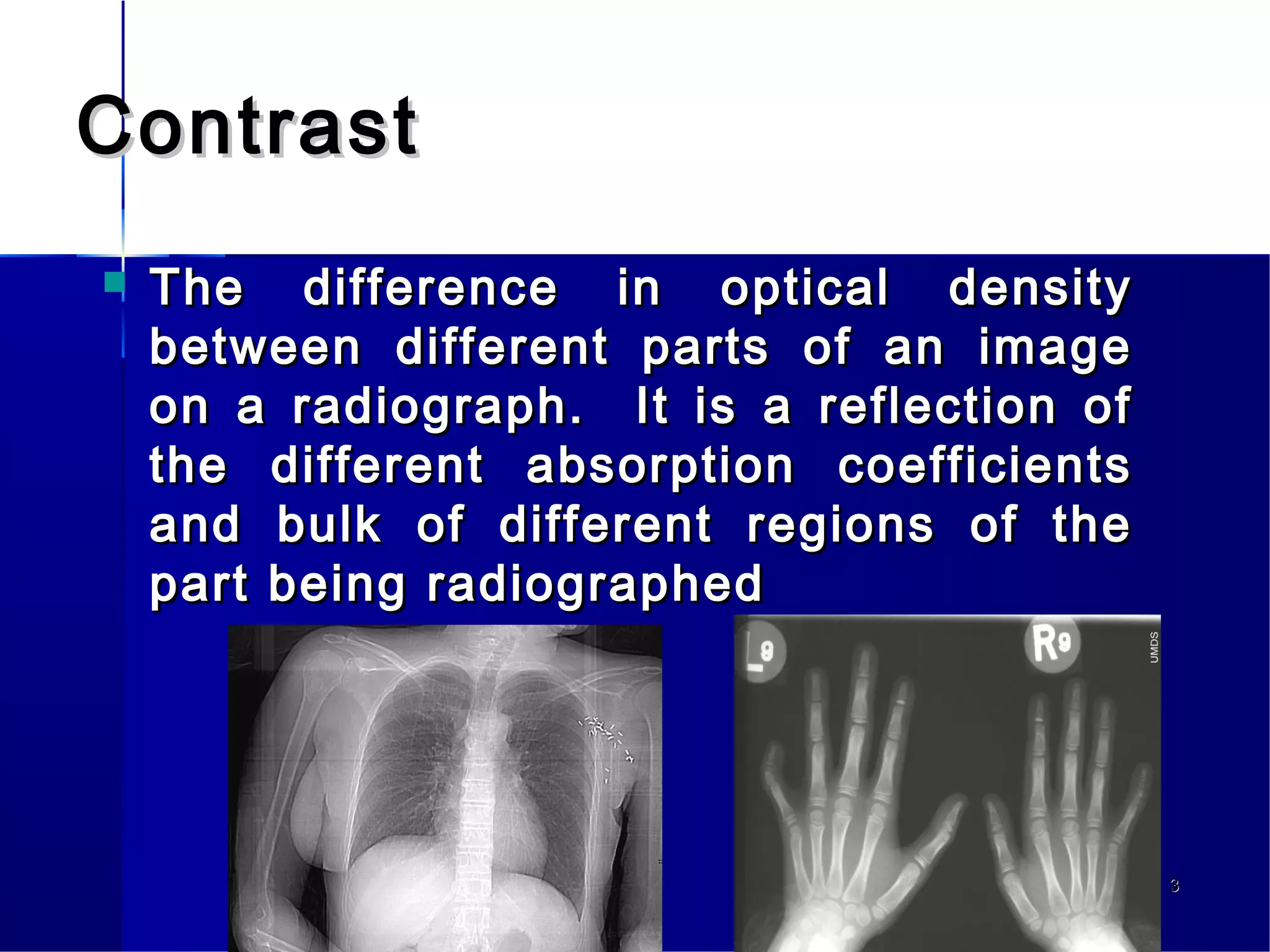 Contrast media | PPT